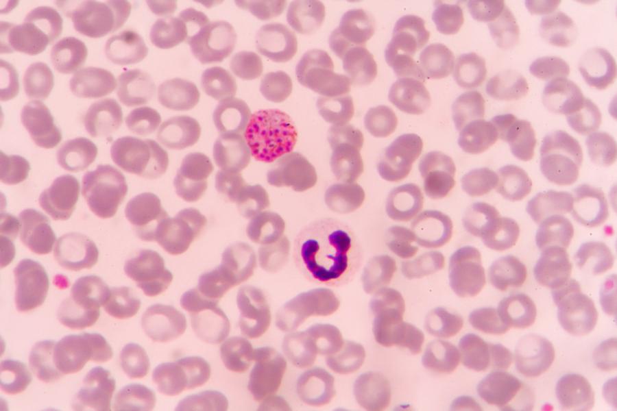 A microscopic view of malaria parasite P. vivax